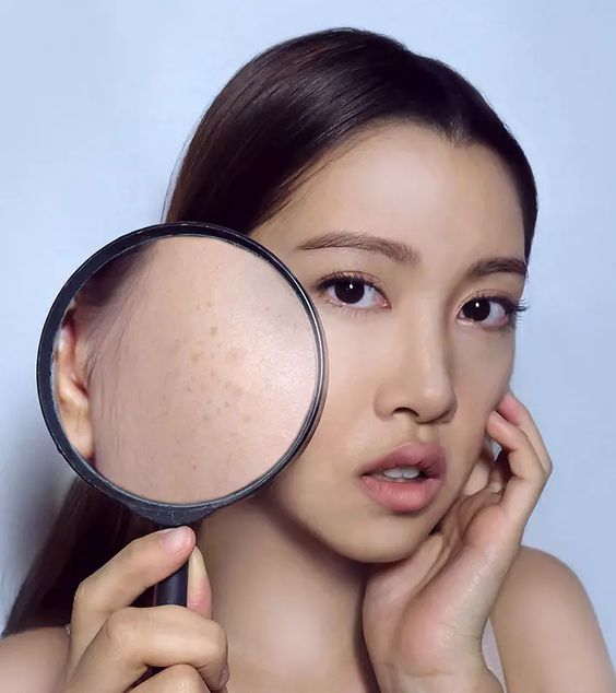 Apa Aja Si Kandungan Skincare Untuk Kulit Flek?